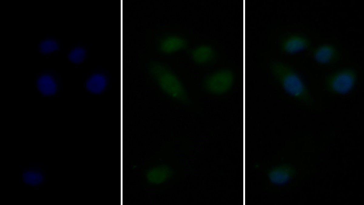 Western Blot; Sample: Lane1: Bovine Cerebrum lysate; Lane2: Bovine Testis lysate; Lane3: Bovine Liver lysate; Lane4: MCF7 cell lysate; Lane5: A431 cell lysate Primary Ab: 2ug/ml Mouse Anti-Bovine HSPA1B Antibody Second Ab: 0.2ug/mL HRP-Linked Caprine Anti-Mouse IgG Polyclonal Antibody