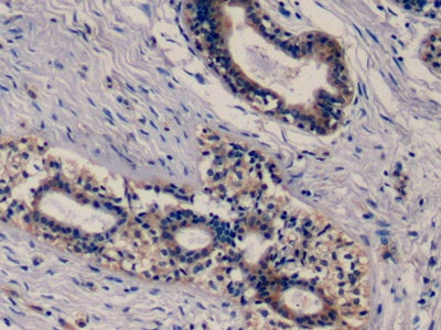 Western Blot; Sample: Lane1: Hela cell lysate; Lane2: MCF7 cell lysate; Lane3: A431 cell lysate; Lane4: Human Placenta lysate Primary Ab: 0.2ug/ml Mouse Anti-Human EGFR Antibody Second Ab: 0.2ug/mL HRP-Linked Caprine Anti-Mouse IgG Polyclonal Antibody