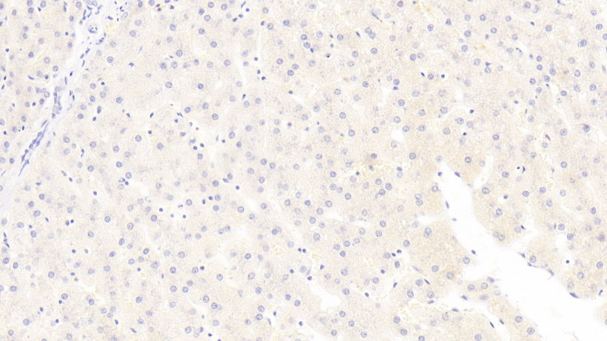 Tissue Inhibitors Of Metalloproteinase 1 (TIMP1) Monoclonal Antibody - image 2