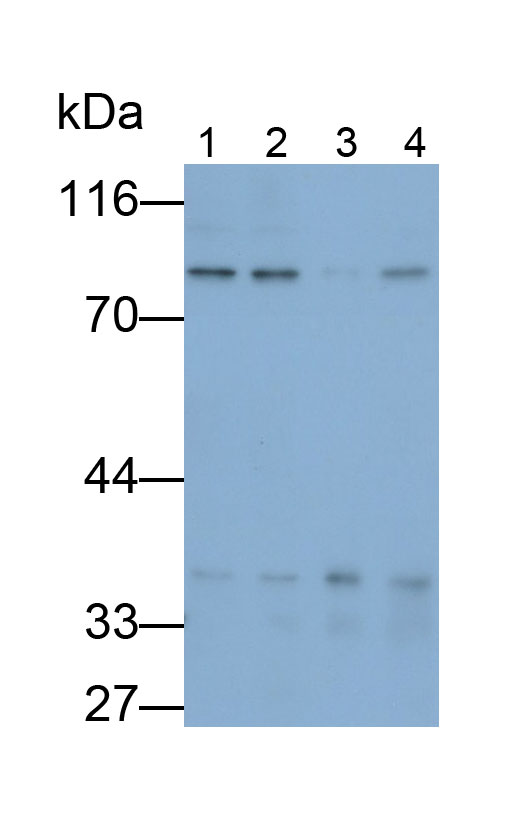 Transforming Growth Factor Beta Receptor II (TGFbR2) Polyclonal Antibody - image 2