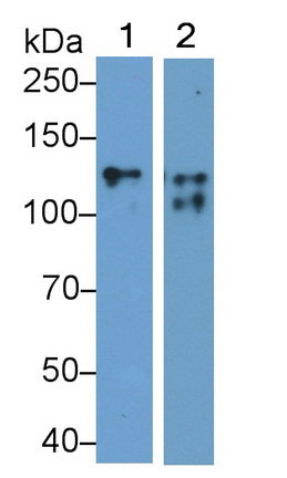 Cluster Of Differentiation 56 (CD56) Monoclonal Antibody - image 2