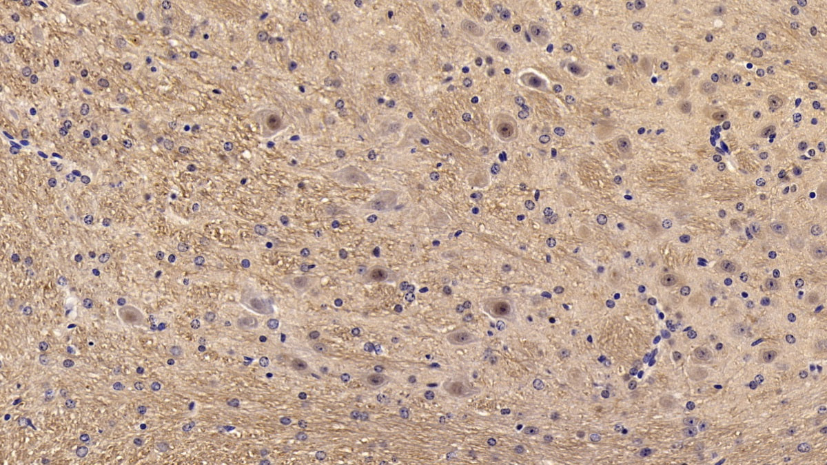 DAB staining on IHC-P; Sample: Mouse Liver Tissue; Primary Ab: 20ug/ml Rabbit Anti-Mouse KISS1R Antibody; Second Ab: 2ug/mL HRP-Linked Caprine Anti-Rabbit IgG Polyclonal Antibody