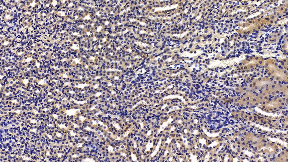 Kisspeptin Receptor (KISS1R) Polyclonal Antibody - image 4