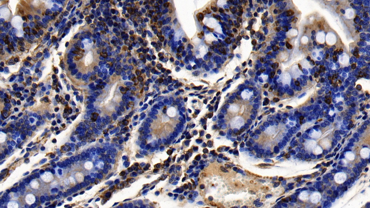 DAB staining on IHC-P; Sample: Human Uterus Tissue; Primary Ab: 10ug/ml Rabbit Anti-Human MSR1 Antibody; Second Ab: 2ug/mL HRP-Linked Caprine Anti-Rabbit IgG Polyclonal Antibody