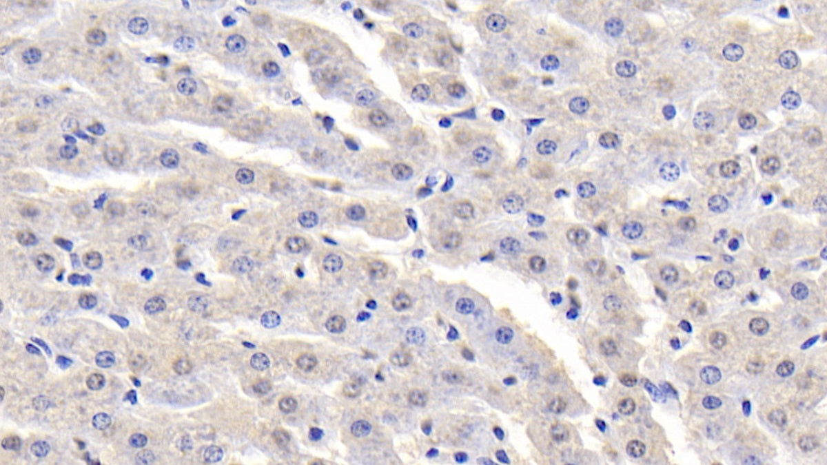 Western Blot; Sample: Lane1: Bovine Serum; Lane2: Bovine Cerebrum lysate; Lane3: HepG2 cell lysate Primary Ab: 2ug/ml Mouse Anti-Bovine aFP Antibody Second Ab: 0.2ug/mL HRP-Linked Caprine Anti-Mouse IgG Polyclonal Antibody