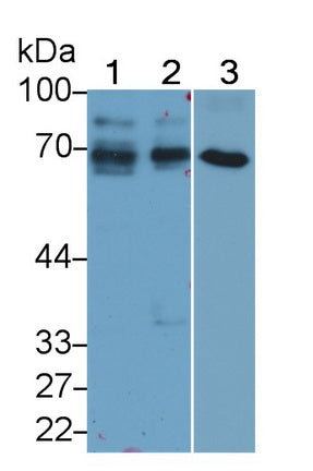 Alpha-Fetoprotein (AFP) Monoclonal Antibody - image 3