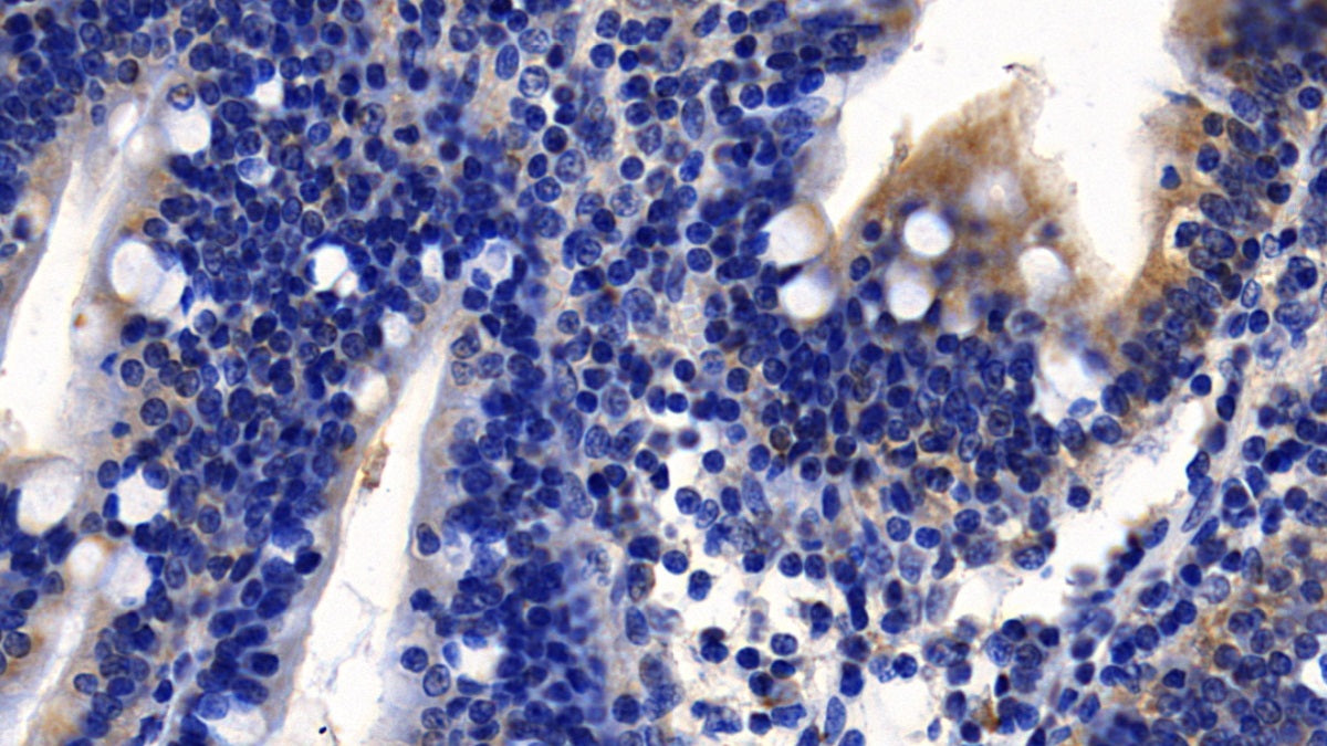 DAB staining on IHC-P; Sample: Human Kidney Tissue; Primary Ab: 10ug/ml Mouse Anti-Human ACE2 Antibody; Second Ab: 2ug/mL HRP-Linked Caprine Anti-Mouse IgG Polyclonal Antibody