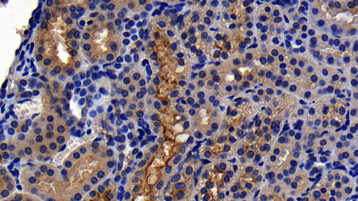 DAB staining on IHC-P; Sample: Human Small intestine Tissue; Primary Ab: 10ug/ml Mouse Anti-Human ACE2 Antibody; Control: Used PBS instead of primary antibody; Second Ab: 2ug/ml HRP-Linked Caprine Anti-Mouse IgG Polyclonal Antibody