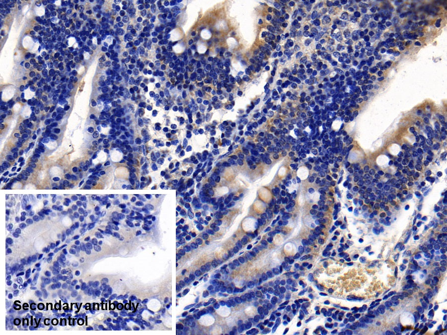 DAB staining on IHC-P; Sample: Human Kidney Tissue; Primary Ab: 10ug/ml Mouse Anti-Human ACE2 Antibody; Control: Used PBS instead of primary antibody; Second Ab: 2ug/ml HRP-Linked Caprine Anti-Mouse IgG Polyclonal Antibody