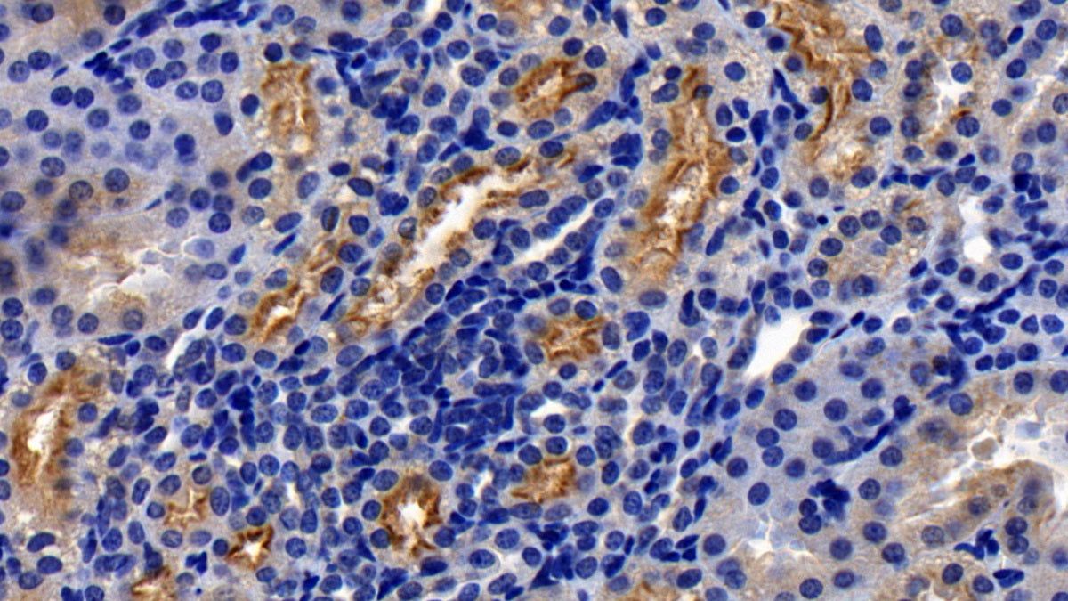 Western Blot; Sample: Mouse Kidney lysate Primary Ab: 0.6ug/ml Mouse Anti-Human ACE2 Antibody Second Ab: 0.2ug/mL HRP-Linked Caprine Anti-Mouse IgG Polyclonal Antibody