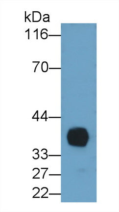 Interleukin 2 Receptor Alpha (IL2Ra) Monoclonal Antibody - image 2