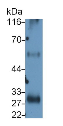 Interleukin 2 Receptor Alpha (IL2Ra) Monoclonal Antibody - image 2