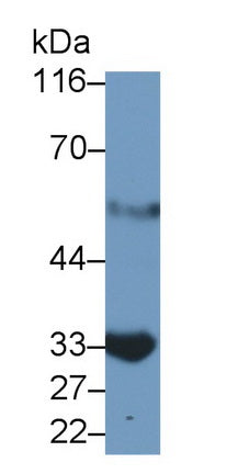 Interleukin 2 Receptor Alpha (IL2Ra) Monoclonal Antibody - image 2