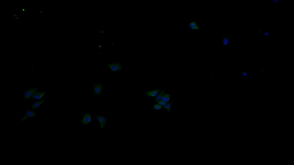 Receptor Tyrosine Protein Kinase erbB-2 (ErbB2) Monoclonal Antibody - image 2