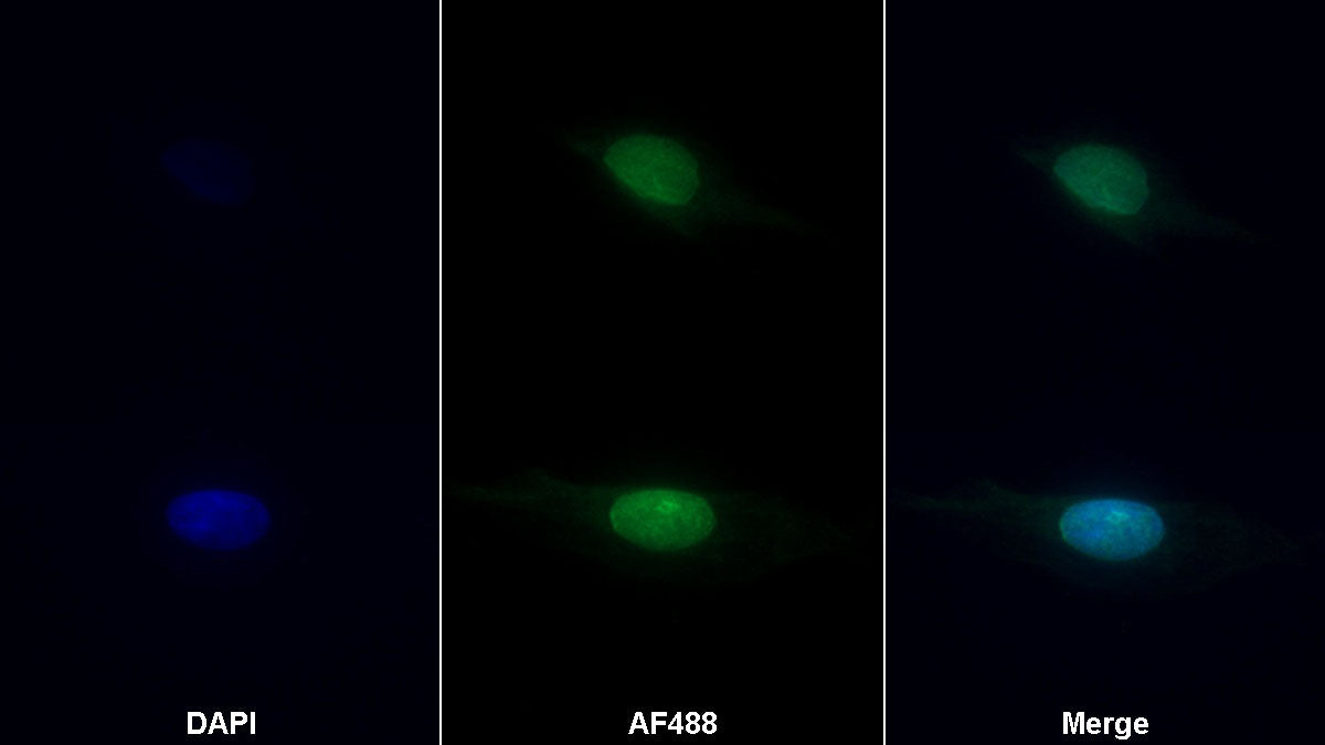 Claudin 2 (CLDN2) Polyclonal Antibody - image 2