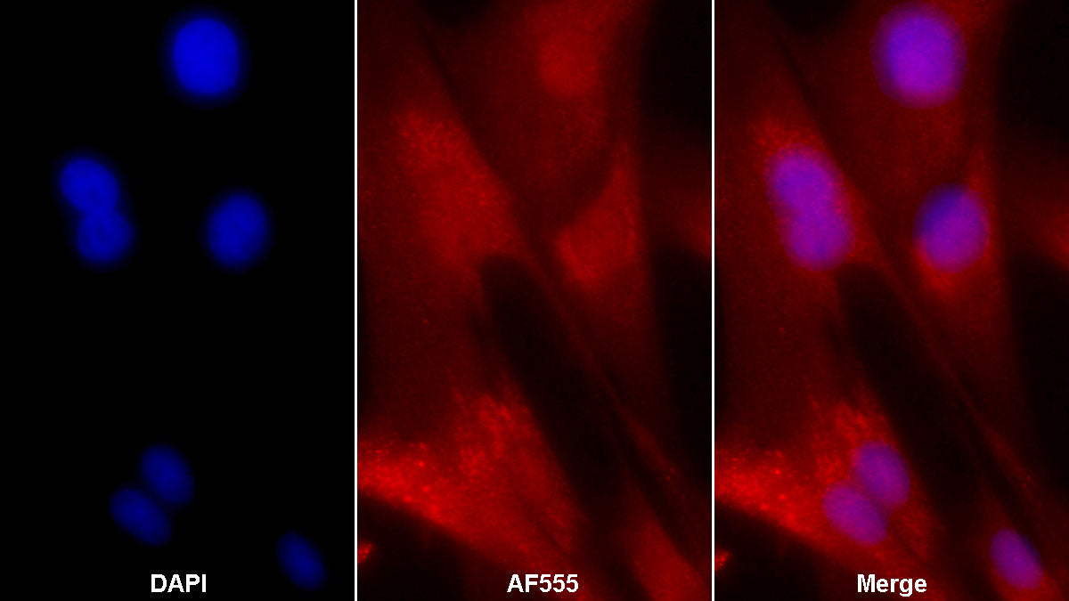 Alkaline Phosphatase, Tissue-nonspecific (ALPL) Monoclonal Antibody - image 3