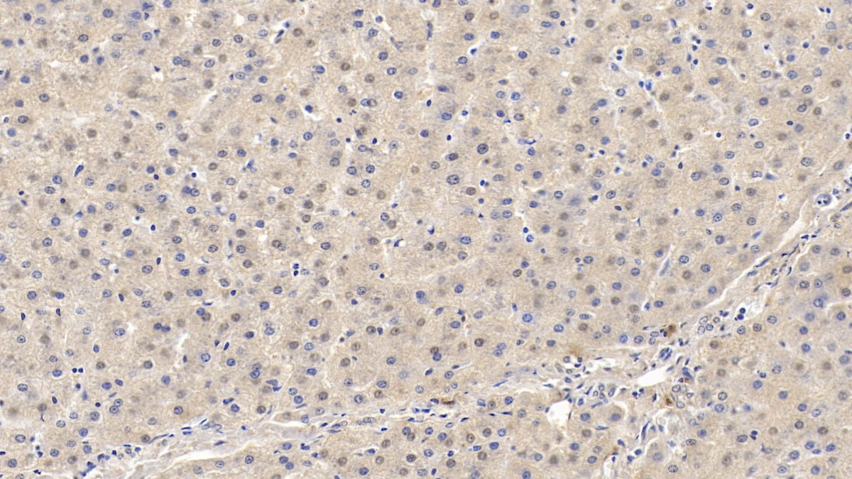 Matrix Metalloproteinase 13 (MMP13) Monoclonal Antibody - image 4
