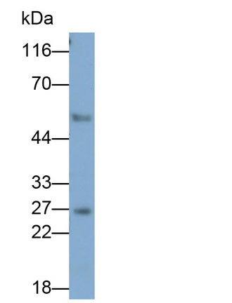 Granzyme K (GZMK) Monoclonal Antibody - image 3