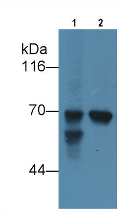 Alpha-Fetoprotein (AFP) Monoclonal Antibody - image 2