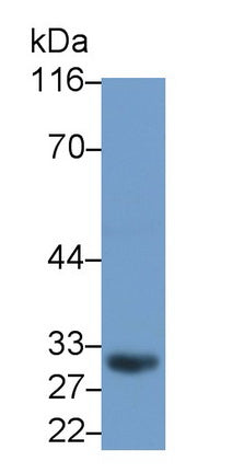 Cluster Of Differentiation 23 (CD23) Monoclonal Antibody - image 2