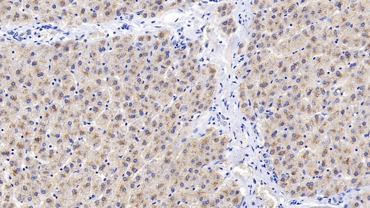 Western Blot; Sample: Rat Liver lysate Primary Ab: 2ug/ml Mouse Anti-Human CEACAM1 Antibody Second Ab: 0.2ug/mL HRP-Linked Rabbit Anti-Mouse IgG Polyclonal Antibody