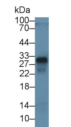 Cluster Of Differentiation 8a (CD8a) Monoclonal Antibody - image 3