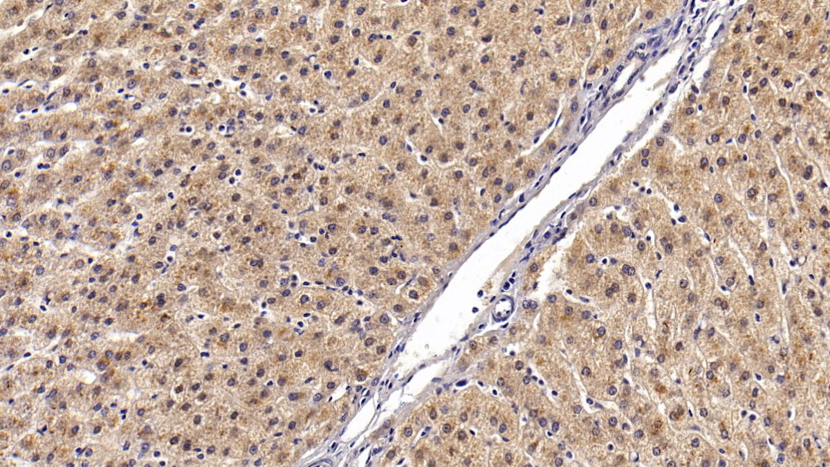 DAB staining on IHC-P; Sample: Human Liver Tissue; Primary Ab: 20ug/ml Mouse Anti-Human ANG Antibody; Control: Used PBS instead of primary antibody; Second Ab: 2ug/ml HRP-Linked Caprine Anti-Mouse IgG Polyclonal Antibody