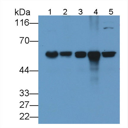 Cluster Of Differentiation 5 (CD5) Monoclonal Antibody - image 2