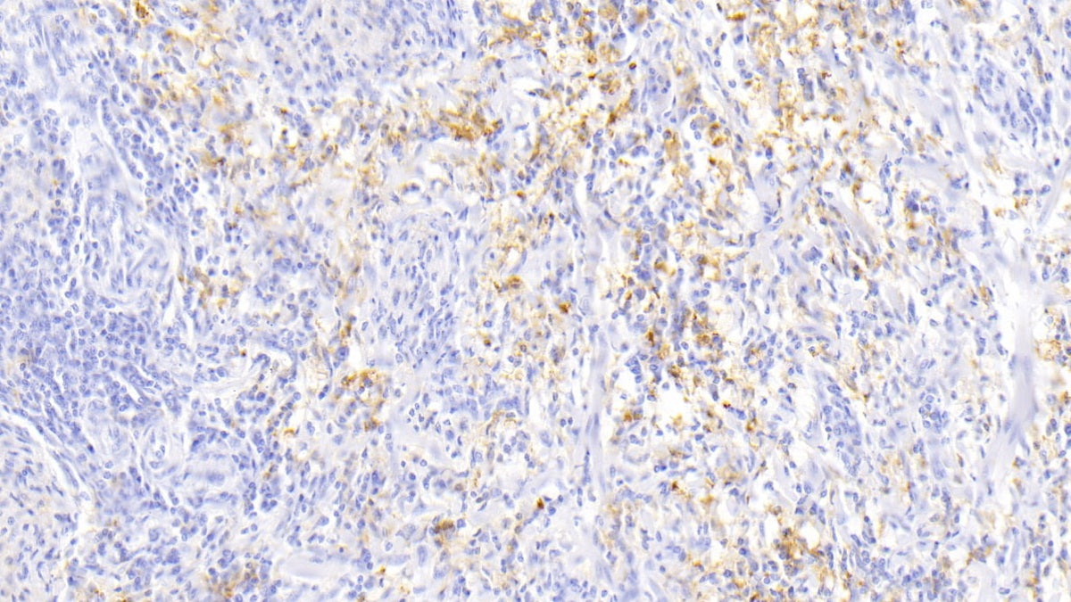 DAB staining on IHC-P; Sample: Human Liver Tissue; Primary Ab: 20ug/ml Mouse Anti-Human FTL Antibody; Second Ab: 2ug/mL HRP-Linked Caprine Anti-Mouse IgG Polyclonal Antibody