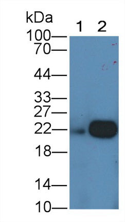 Ferritin, Light Polypeptide (FTL) Monoclonal Antibody - image 5