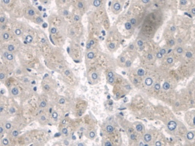DAB staining on IHC-P; Samples: Human Stomach Tissue; Primary Ab: 20ug/ml Rabbit Anti-Human SPRY2 Antibody; Second Ab: 2ug/mL HRP-Linked Caprine Anti-Rabbit IgG Polyclonal Antibody
