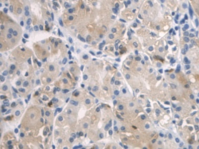WB Image