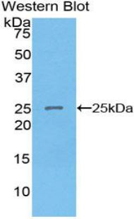 Western Blot; Sample: Human Lung lysate; Primary Ab: 3ug/ml Rabbit Anti-Human SPRY2 Antibody; Second Ab: 0.2ug/mL HRP-Linked Caprine Anti-Rabbit IgG Polyclonal Antibody