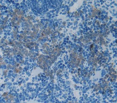 Western Blot; Sample: Recombinant IL2, Rat.