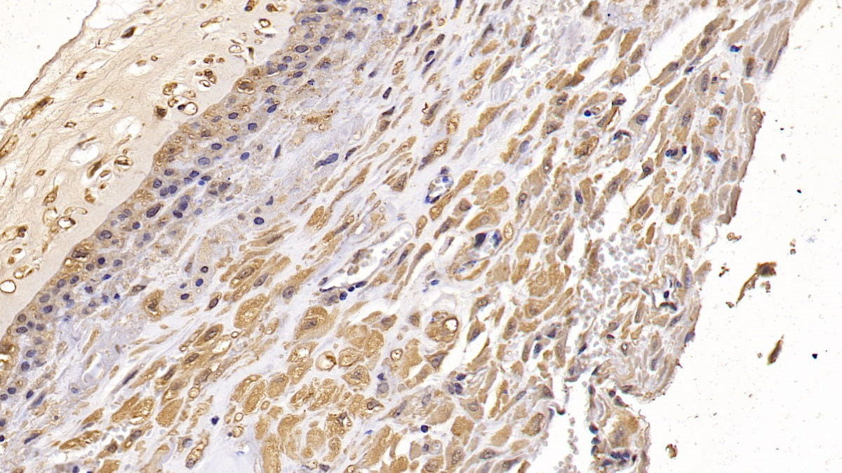 DAB staining on IHC-P; Sample: Human Small intestine Tissue; Primary Ab: 10ug/ml Mouse Anti-Human CD73 Antibody; Second Ab: 2ug/mL HRP-Linked Caprine Anti-Mouse IgG Polyclonal Antibody