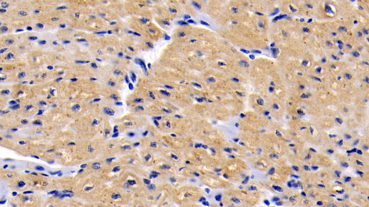 DAB staining on IHC-P; Sample: Human Spleen Tissue; Primary Ab: 30ug/ml Mouse Anti-Human IL6 Antibody; Second Ab: 2ug/mL HRP-Linked Caprine Anti-Mouse IgG Polyclonal Antibody