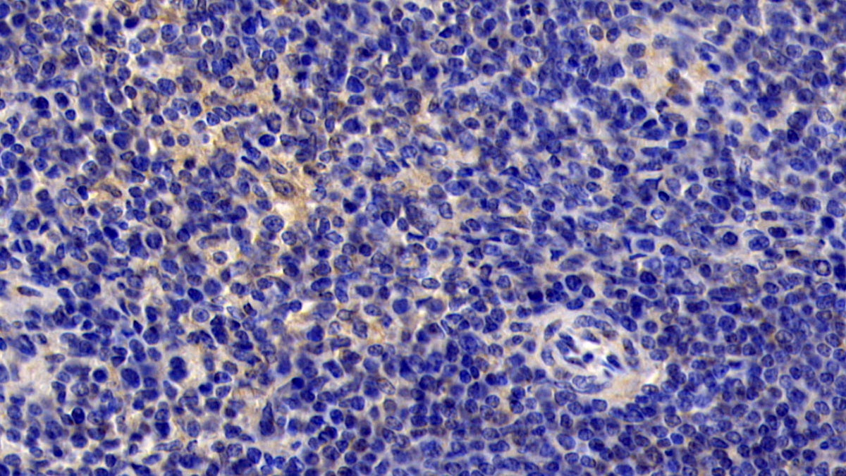 Interleukin 6 (IL6) Monoclonal Antibody - image 3
