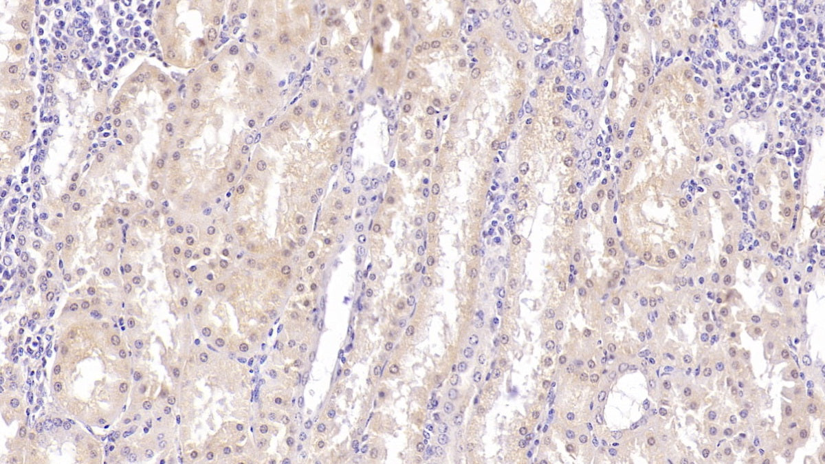 Western Blot; Sample: Lane1: Human Lung lysate; Lane2: Human Serum Primary Ab: 3ug/ml Mouse Anti-Human LUM Antibody Second Ab: 0.2ug/mL HRP-Linked Caprine Anti-Mouse IgG Polyclonal Antibody