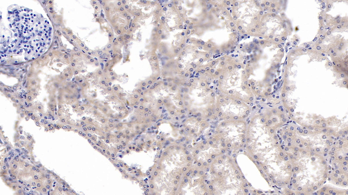 DAB staining on IHC-P; Sample: Human Kidney Tissue; Primary Ab: 10ug/ml Mouse Anti-Human KPNa2 Antibody; Control: Used PBS instead of primary antibody; Second Ab: 2ug/ml HRP-Linked Caprine Anti-Mouse IgG Polyclonal Antibody