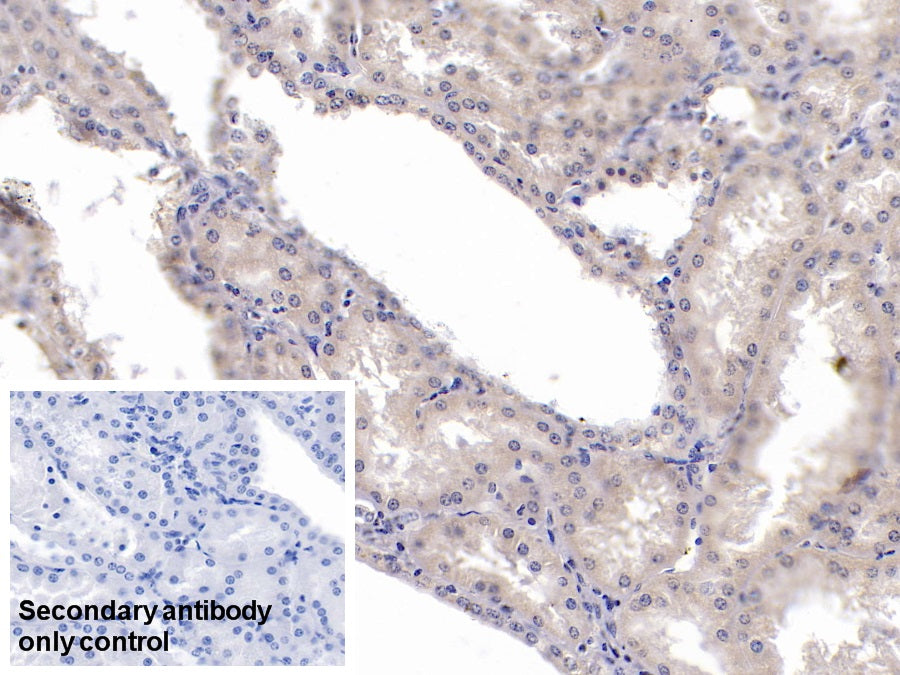 Western Blot; Sample: Lane1: U2OS cell lysate; Lane2: Jurkat cell lysate; Lane3: 293T cell lysate Primary Ab: 3ug/ml Mouse Anti-Human KPNa2 Antibody Second Ab: 0.2ug/mL HRP-Linked Caprine Anti-Mouse IgG Polyclonal Antibody