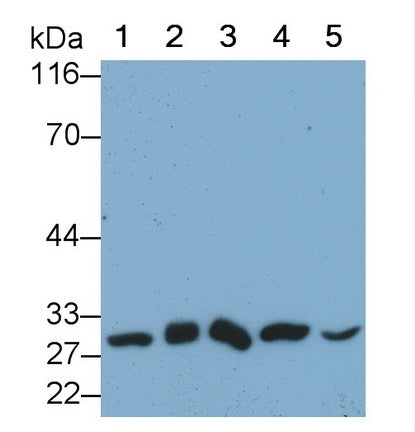 Phosphoglycerate Mutase 1, Brain (PGAM1) Monoclonal Antibody - image 2