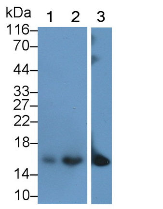Western Blot; Sample: Lane1: Porcine Esophagus lysate; Lane2: MCF7 cell lysate; Primary Ab: 0.2ug/ml Mouse Anti-Human CRABP2 Antibody; Second Ab: 0.2ug/mL HRP-Linked Caprine Anti-Mouse IgG Polyclonal Antibody