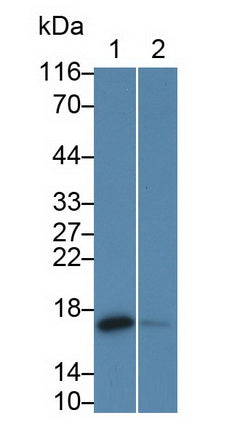 Cellular Retinoic Acid Binding Protein 2 (CRABP2) Monoclonal Antibody - image 3