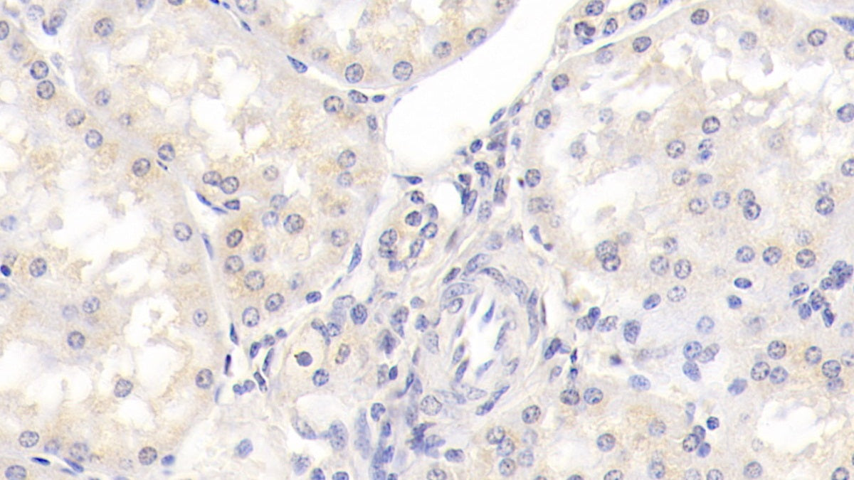 Integrin Beta 1 (ITGb1) Monoclonal Antibody - image 3