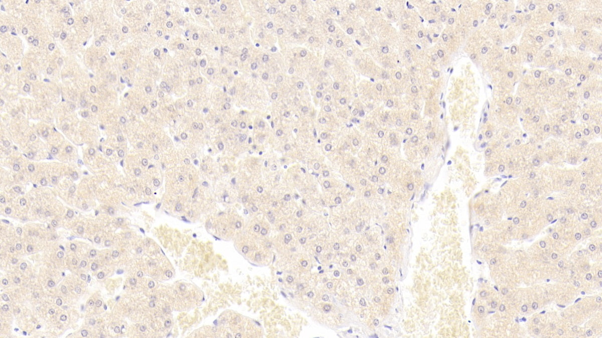DAB staining on IHC-P; Sample: Human Liver Tissue; Primary Ab: 20ug/ml Mouse Anti-Human S100A9 Antibody; Control: Used PBS instead of primary antibody; Second Ab: 2ug/ml HRP-Linked Caprine Anti-Mouse IgG Polyclonal Antibody
