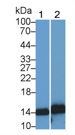 S100 Calcium Binding Protein A9 (S100A9) Monoclonal Antibody - image 4