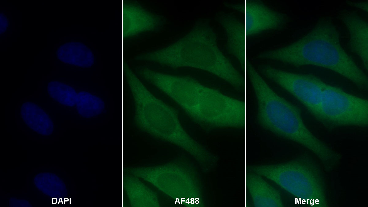 Western Blot; Sample: Human Serum Primary Ab: 0.5ug/ml Mouse Anti-Human C3a Antibody Second Ab: 0.2ug/mL HRP-Linked Caprine Anti-Mouse IgG Polyclonal Antibody