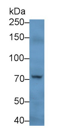 Peptidyl Arginine Deiminase Type IV (PADI4) Monoclonal Antibody - image 2