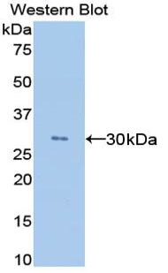 Western Blot; Sample: Rat Cerebrum lysate; Primary Ab: 0.2ug/ml Mouse Anti-Rat ANGPTL4 Antibody; Second Ab: 0.2ug/ml HRP-Linked Caprine Anti-Mouse IgG Polyclonal Antibody
