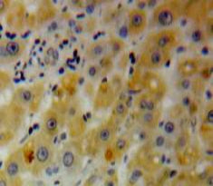 WB Image
